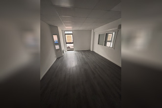  localcommercial lens 62300