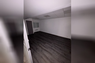  localcommercial lens 62300