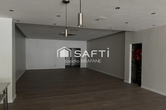  localcommercial lens 62300