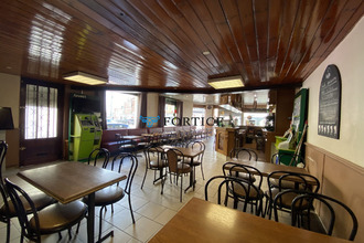  localcommercial lens 62300