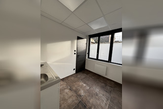  localcommercial lens 62300